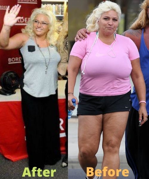 What did Beth Chapman look like before and after weight loss?

